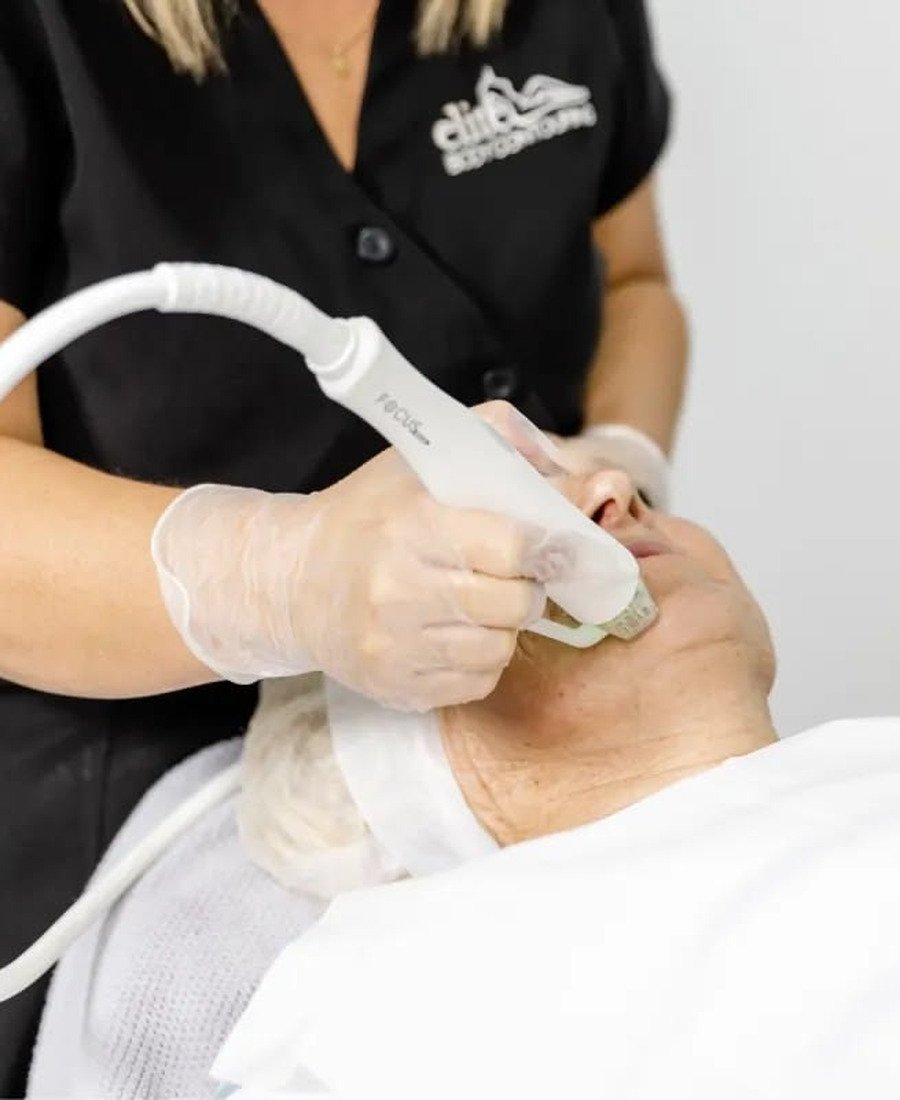 Body RF Microneedling Dr. Elham Keikha Dubai