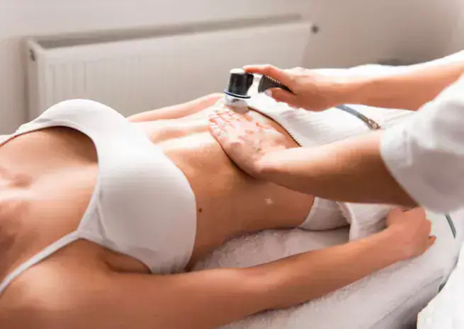 Body RF Microneedling on the abdomen with a handheld device in a clinical setting at Dr. Elham Keikha clinic in Dubai