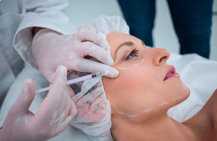 Profile view of a patient receiving a Botox injection near the eye and forehead area with treatment guide markings in Dubai
