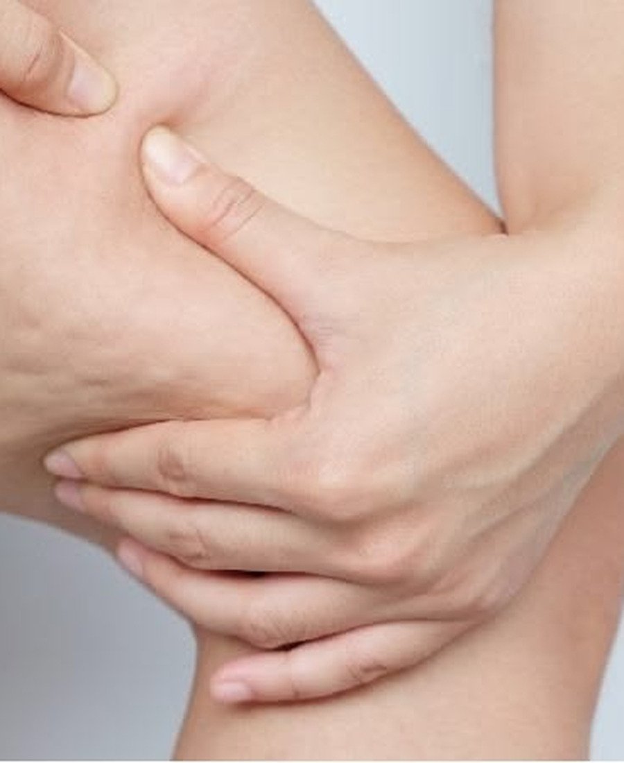 Cellulite Treatment Dr. Elham Keikha Dubai