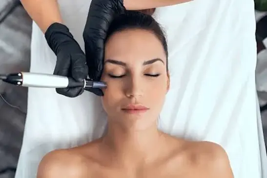 Close-up of a patient receiving advanced regenerative exosome skin therapy with microneedling device from a specialist in black gloves at Dr. Elham Keikha clinic in Dubai