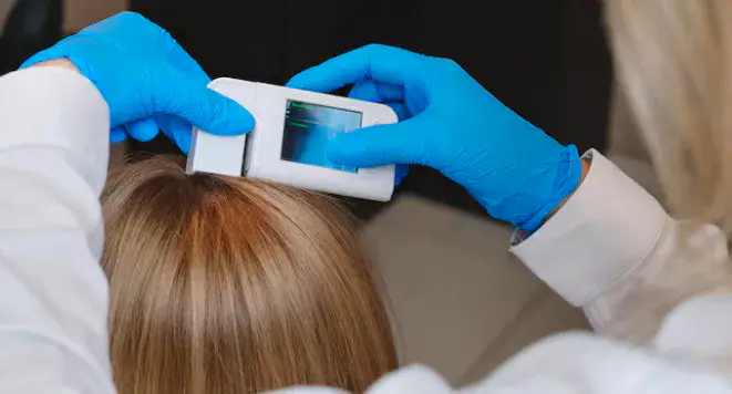A medical professional using a handheld digital scalp scanner to perform trichoscopy hair loss analysis on a patient with blonde hair in Dubai - Dr. Elham Keikha