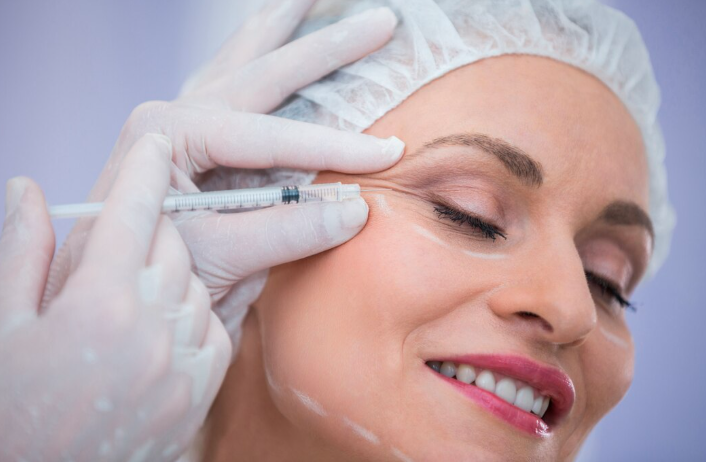Smiling patient receiving a precise crow's feet Botox injection with facial treatment markings in Dubai