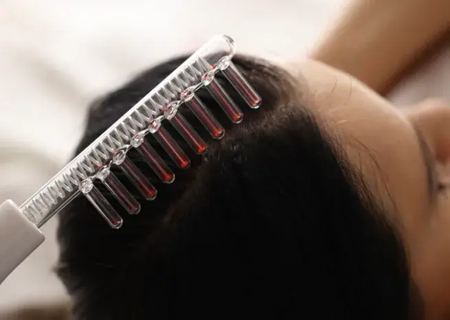 High-frequency glass electrode comb applied to the scalp during PDRN hair therapy in Dubai