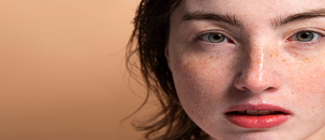 Extreme close-up portrait of a woman with visible freckles and skin pigmentation across her nose and cheeks, looking forward against a neutral tan background, representing skin concerns for pigmentation and melasma treatment in Dubai