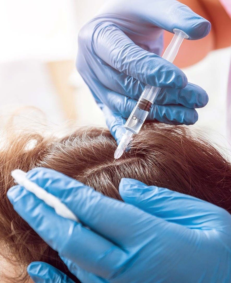 PRP Hair Therapy Dr. Elham Keikha Dubai