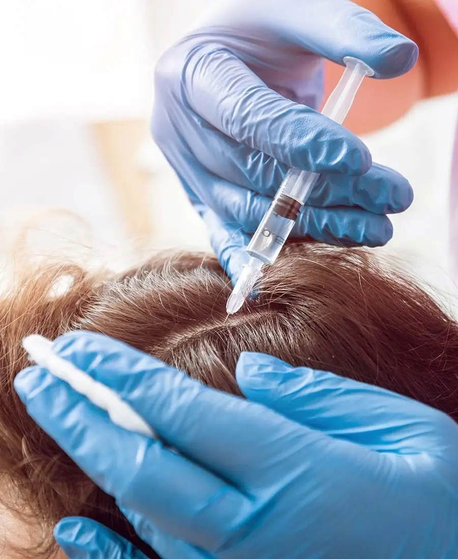 PRP Hair Therapy Dr. Elham Keikha Dubai