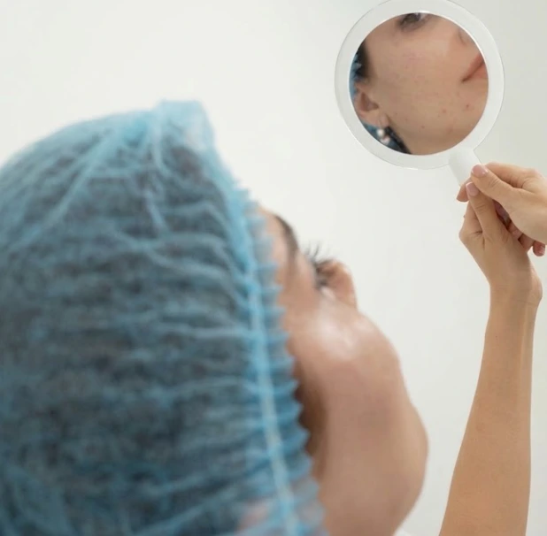 Woman wearing a medical hair cap examining her facial skin in a handheld mirror during a skin booster consultation.