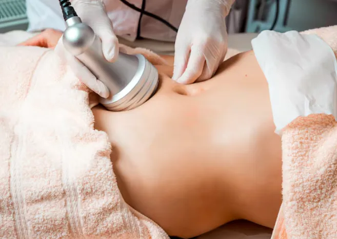Professional Body RF Microneedling treatment being performed on a patient's abdomen for skin tightening at Dr. Elham Keikha clinic in Dubai