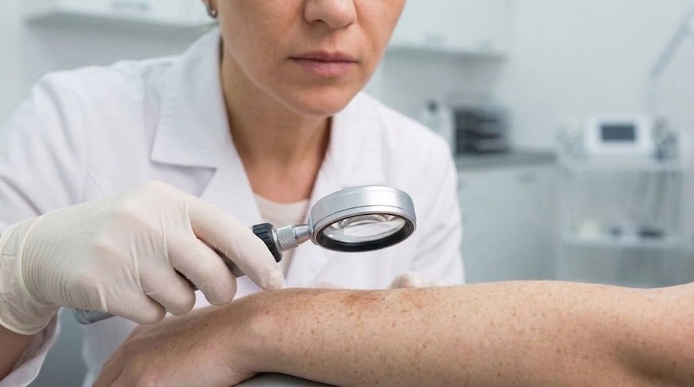 See a Dermatologist