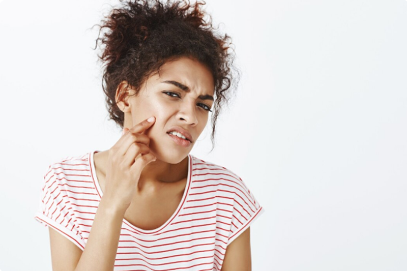 Acne Scars on Dark Skin: Causes, Types & Treatments