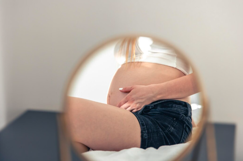 What Is Pregnancy Hyperpigmentation?