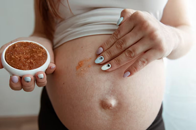 How Long Does Pregnancy Hyperpigmentation Last?