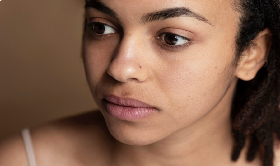 Important Precautions for Darker Skin