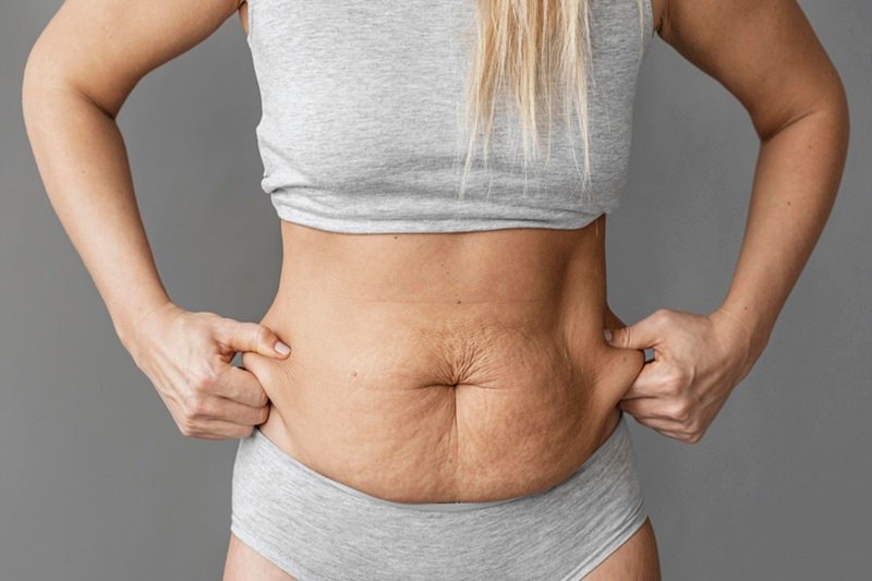 skin may not have enough elasticity