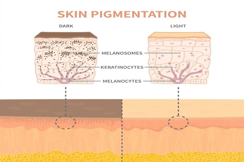 Causes of Rebound Pigmentation